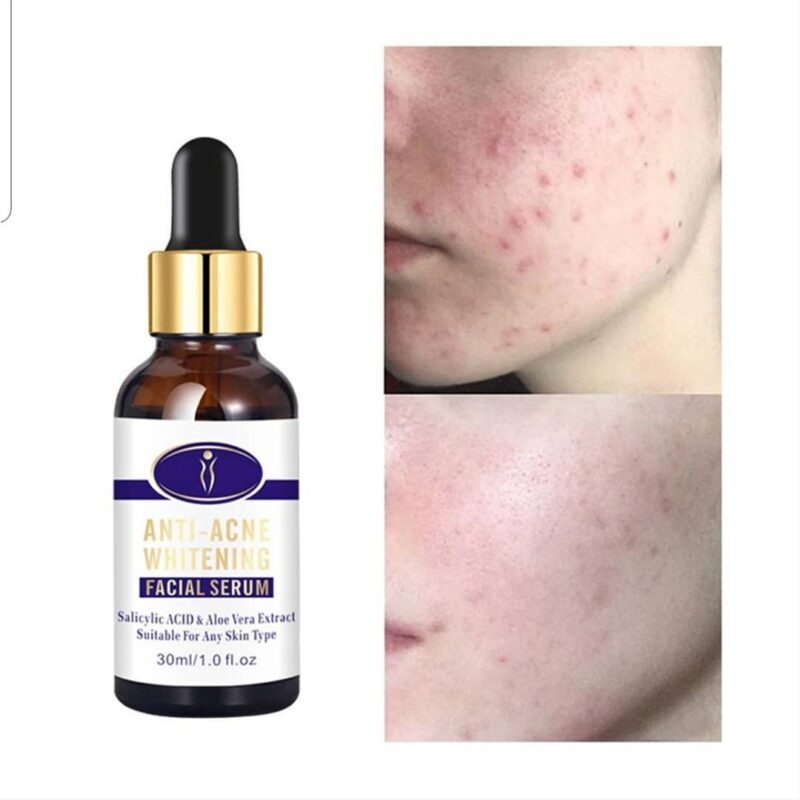 Aichun Whitening Facial Serum Hans Naturals