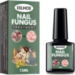 Eelhoe Nail Fungus Treatment